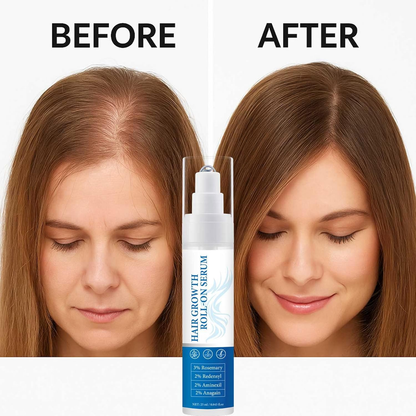 Rosemary hair growth roll-on serum for thicker, fuller hair; natural formula for quick absorption.