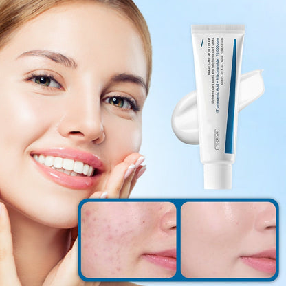 👩TX Cream| Lightens age spots, brightens and moisturizes, improves dull skin