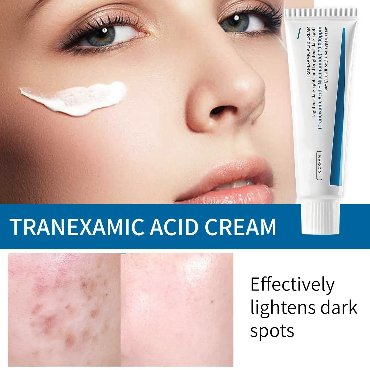 👩TX Cream| Lightens age spots, brightens and moisturizes, improves dull skin